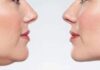 Jaw Fat: 9 Effective Ways to Reduce Double Chin Jaw Fat: 9 Ways to Reduce Double Chin